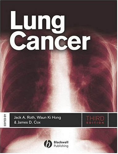 Lung Cancer 3rd ed Edition (PDF Instant Download)
