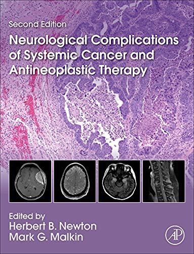 Neurological Complications of Systemic Cancer and Antineoplastic Therapy 2 Edition (PDF Instant Download)