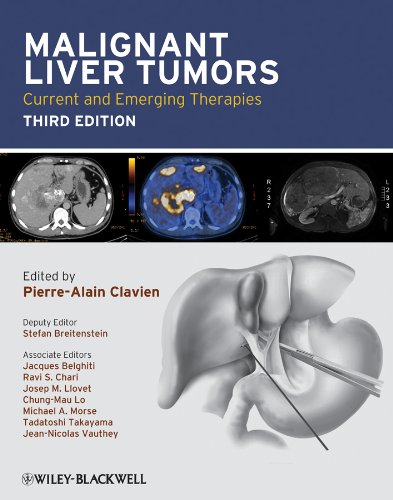 Malignant Liver Tumors, Third Edition: Current and Emerging Therapies 3 Edition (PDF Instant Download)