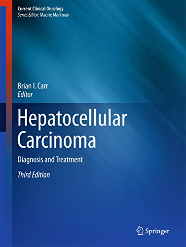 Hepatocellular Carcinoma: Diagnosis and Treatment (3rd Edition) (PDF Instant Download)