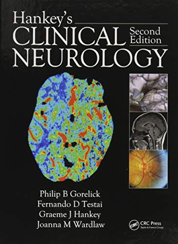 Hankey?s Clinical Neurology (2nd Edition) (PDF Instant Download)