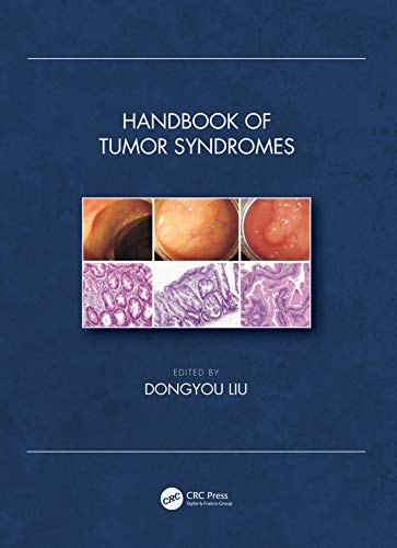 Handbook of Tumor Syndromes (PDF Instant Download)