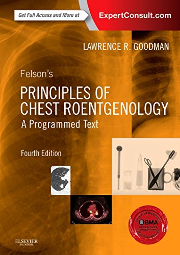 Felson?s Principles of Chest Roentgenology 4th Edition (PDF Instant Download)