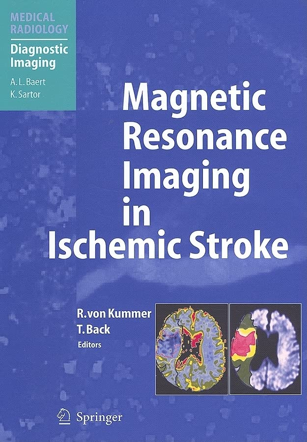 Magnetic Resonance Imaging in Ischemic Stroke 1 Edition (PDF Instant Download)
