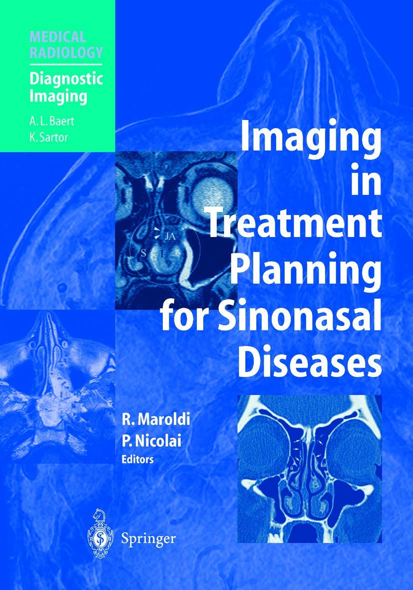 Imaging in Treatment Planning for Sinonasal Diseases 1 Edition (PDF Instant Download)