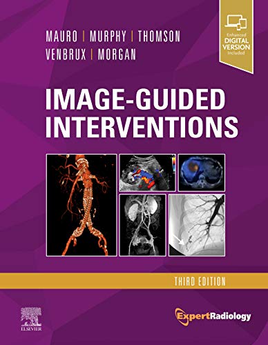 Image-Guided Interventions: Expert Radiology Series (PDF Instant Download)
